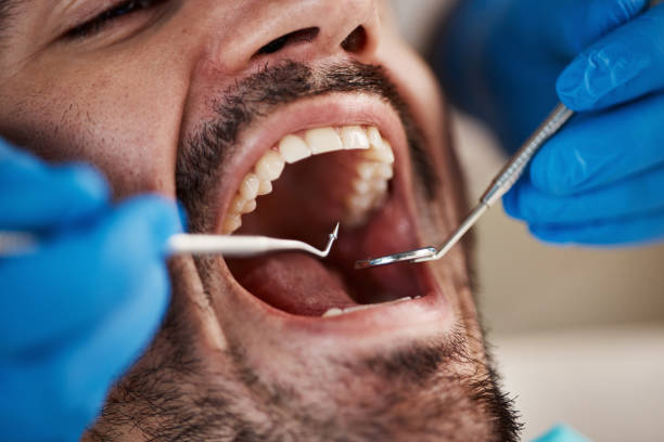 Dentist for Dental Trauma in MD